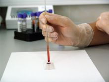 labordiagnosztika